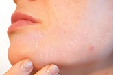 10 dấu hiệu tưởng bình thường của cơ thể nhưng báo hiệu nguy hại 10 dấu hiệu tưởng bình thường của cơ thể nhưng báo hiệu nguy hại