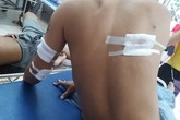 Thanh Hóa: 3 thanh niên bị nhóm người bịt mặt bắn trọng thương Thanh Hóa: 3 thanh niên bị nhóm người bịt mặt bắn trọng thương