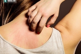 7 dấu hiệu cảnh báo ung thư mà 90% mọi người thường bỏ qua 7 dấu hiệu cảnh báo ung thư mà 90% mọi người thường bỏ qua