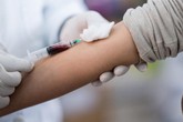 Lợi ích to lớn từ tư vấn xét nghiệm HIV tại cộng đồng Lợi ích to lớn từ tư vấn xét nghiệm HIV tại cộng đồng