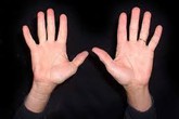 Tự xem số phận qua bàn tay: Tai họa, bệnh tật trong lòng bàn tay Tự xem số phận qua bàn tay: Tai họa, bệnh tật trong lòng bàn tay