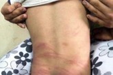 Dấu hiệu nhận biết con bạn bị bạo hành ở lớp Dấu hiệu nhận biết con bạn bị bạo hành ở lớp