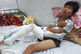 Cậu bé bị hổ tấn công, cào nát chân nằm đau đớn trong viện Bỏng Cậu bé bị hổ tấn công, cào nát chân nằm đau đớn trong viện Bỏng