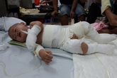 Mẹ câm điếc, bố mù, con trai 10 tháng tuổi nguy kịch vì bỏng nặng Mẹ câm điếc, bố mù, con trai 10 tháng tuổi nguy kịch vì bỏng nặng