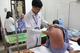 Bị vảy nến có chữa khỏi hoàn toàn được không? Bị vảy nến có chữa khỏi hoàn toàn được không?