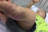 Công an Hà Nội khởi tố vụ bé trai 1 tuổi bị bạo hành đến co giật, hôn mê Công an Hà Nội khởi tố vụ bé trai 1 tuổi bị bạo hành đến co giật, hôn mê