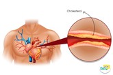 Cholesterol không xấu như ta nghĩ Cholesterol không xấu như ta nghĩ