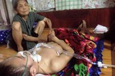 Cơ cực cảnh bố chăm con tai nạn, mẹ tâm thần Cơ cực cảnh bố chăm con tai nạn, mẹ tâm thần