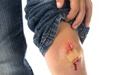 Có thể tử vong do nhiễm uốn ván từ một vết xước nhỏ Có thể tử vong do nhiễm uốn ván từ một vết xước nhỏ
