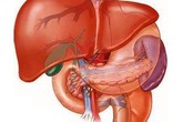 Gan nhiễm mỡ, tránh ăn gì? Gan nhiễm mỡ, tránh ăn gì?