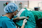 Bộ Y tế chính thức lên tiếng trước thông tin cấm gây tê tủy sống khi sinh mổ Bộ Y tế chính thức lên tiếng trước thông tin cấm gây tê tủy sống khi sinh mổ