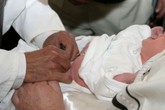 Cách phát hiện trẻ mắc chứng vùi dương vật Cách phát hiện trẻ mắc chứng vùi dương vật