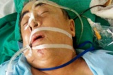 Vác dao chém tới tấp 5 người nhà hàng xóm vì không bán nước chè Vác dao chém tới tấp 5 người nhà hàng xóm vì không bán nước chè