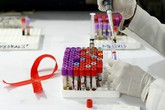 “HIV sẽ không bao giờ bị loại trừ nếu không có nghiên cứu khoa học” “HIV sẽ không bao giờ bị loại trừ nếu không có nghiên cứu khoa học”