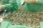 Vợ nuốt 7.000 đôla vào bụng để giấu chồng sau khi cãi nhau Vợ nuốt 7.000 đôla vào bụng để giấu chồng sau khi cãi nhau