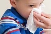 Trẻ bị chảy máu cam: Tại sao không cho con ngả đầu về phía sau? Trẻ bị chảy máu cam: Tại sao không cho con ngả đầu về phía sau?