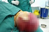 Để tóc xõa trong lúc làm việc, nữ công nhân bị máy sản xuất giật phăng cả mảng da đầu Để tóc xõa trong lúc làm việc, nữ công nhân bị máy sản xuất giật phăng cả mảng da đầu