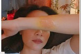Tay bị bỏng, Hồ Ngọc Hà buồn bã cầu cứu fan Tay bị bỏng, Hồ Ngọc Hà buồn bã cầu cứu fan
