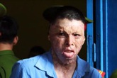 Hình hài của nam thanh niên dùng xăng thiêu sống người yêu Hình hài của nam thanh niên dùng xăng thiêu sống người yêu