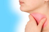 Triệu chứng ung thư vòm họng bạn không nên bỏ qua Triệu chứng ung thư vòm họng bạn không nên bỏ qua