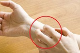 Các dấu hiệu cơ thể bị nhiễm độc và cách giải độc cho nội tạng đơn giản ai cũng làm được Các dấu hiệu cơ thể bị nhiễm độc và cách giải độc cho nội tạng đơn giản ai cũng làm được