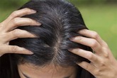 Đừng xem nhẹ, tóc bạc sớm cũng là dấu hiệu cảnh báo hàng loạt vấn đề sức khỏe Đừng xem nhẹ, tóc bạc sớm cũng là dấu hiệu cảnh báo hàng loạt vấn đề sức khỏe