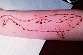 Cá voi xanh, trò chơi thử thách bệnh hoạn khiến hơn 100 bạn trẻ tự sát Cá voi xanh, trò chơi thử thách bệnh hoạn khiến hơn 100 bạn trẻ tự sát