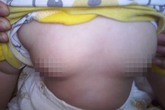 Bố mẹ phát hoảng khi con gái 5 tháng tuổi dậy thì như thiếu nữ vì món ăn hằng ngày Bố mẹ phát hoảng khi con gái 5 tháng tuổi dậy thì như thiếu nữ vì món ăn hằng ngày