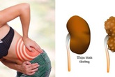 Để thận khỏe mạnh, không lo suy thận và chạy thận, bạn đừng bao giờ làm những điều này Để thận khỏe mạnh, không lo suy thận và chạy thận, bạn đừng bao giờ làm những điều này