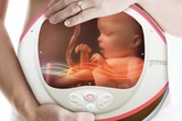 Những thiết bị có tác dụng thần kỳ nhưng ít ai biết đến sự tồn tại của chúng Những thiết bị có tác dụng thần kỳ nhưng ít ai biết đến sự tồn tại của chúng