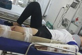 Hà Nội: Anh trai tìm người gây tai nạn khiến em gái gãy tay, chân rồi bỏ chạy Hà Nội: Anh trai tìm người gây tai nạn khiến em gái gãy tay, chân rồi bỏ chạy