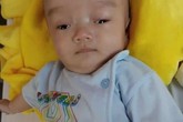Rớt nước mắt hình ảnh bé trai 3 tháng tuổi bị não úng thủy Rớt nước mắt hình ảnh bé trai 3 tháng tuổi bị não úng thủy