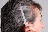 Xem vị trí tóc bạc đoán bệnh của gan, thận, dạ dày, lá lách Xem vị trí tóc bạc đoán bệnh của gan, thận, dạ dày, lá lách