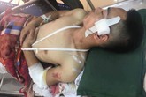 Giây phút kinh hoàng của nạn nhân bị 30 côn đồ truy sát ở Hải Dương Giây phút kinh hoàng của nạn nhân bị 30 côn đồ truy sát ở Hải Dương