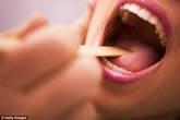 Không chỉ "quan hệ" đường miệng, thói quen lười biếng này cũng có thể dẫn đến ung thư vòm họng Không chỉ "quan hệ" đường miệng, thói quen lười biếng này cũng có thể dẫn đến ung thư vòm họng