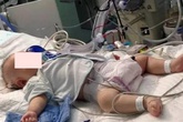 Uống sữa công thức đặc hơn tiêu chuẩn, bé sơ sinh 1 tháng phải… cắt ruột Uống sữa công thức đặc hơn tiêu chuẩn, bé sơ sinh 1 tháng phải… cắt ruột