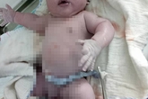 Vĩnh Phúc: Bé trai chào đời nặng kỷ lục 7,1kg Vĩnh Phúc: Bé trai chào đời nặng kỷ lục 7,1kg