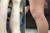 Vụ giáo viên đánh liên tiếp học sinh: Chỉ còn 2 tháng nữa cô giáo sẽ nghỉ hưu Vụ giáo viên đánh liên tiếp học sinh: Chỉ còn 2 tháng nữa cô giáo sẽ nghỉ hưu