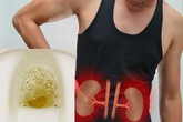 Chàng trai 32 tuổi đột nhiên bị suy thận cấp chỉ vì làm 2 việc trong thời gian dài Chàng trai 32 tuổi đột nhiên bị suy thận cấp chỉ vì làm 2 việc trong thời gian dài