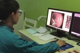 Đau bụng cả tháng tưởng bị dạ dày, người phụ nữ sốc nặng thấy thứ không tưởng này trong người Đau bụng cả tháng tưởng bị dạ dày, người phụ nữ sốc nặng thấy thứ không tưởng này trong người