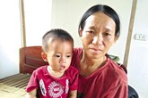 Mong manh cháu bé vướng căn bệnh cả thế giới có 9 ca mắc Mong manh cháu bé vướng căn bệnh cả thế giới có 9 ca mắc