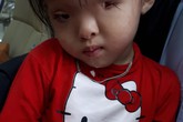 Cô bé 3 tuổi bị dị tật mắt vẫn cần sự giúp đỡ của cộng đồng để tìm ánh sáng Cô bé 3 tuổi bị dị tật mắt vẫn cần sự giúp đỡ của cộng đồng để tìm ánh sáng