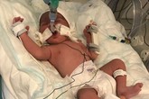 Bà bầu tử vong vì nỏ bắn xuyên bụng, thai nhi sống sót thần kỳ Bà bầu tử vong vì nỏ bắn xuyên bụng, thai nhi sống sót thần kỳ