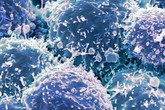 Chế tạo thành công loại virus chuyên diệt tế bào ung thư Chế tạo thành công loại virus chuyên diệt tế bào ung thư