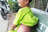 Cô giáo đánh học sinh khuyết tật bầm tím là người hiền lành Cô giáo đánh học sinh khuyết tật bầm tím là người hiền lành