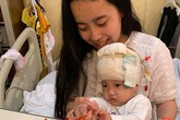 Bé sinh non bị não úng thủy trải qua 16 lần mổ vẫn chưa “thoát” bệnh viện Bé sinh non bị não úng thủy trải qua 16 lần mổ vẫn chưa “thoát” bệnh viện