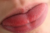 Màu sắc của lưỡi cảnh báo bệnh Màu sắc của lưỡi cảnh báo bệnh