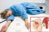 Những lưu ý “cơ hội vàng” để xử trí bệnh đột quỵ Những lưu ý “cơ hội vàng” để xử trí bệnh đột quỵ