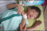 Bé 5 tuổi tử vong sau gần 1 tháng bị chó cắn là do bệnh dại? Bé 5 tuổi tử vong sau gần 1 tháng bị chó cắn là do bệnh dại?