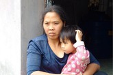 Cuộc đời truân chuyên của người phụ nữ mắc bệnh lạ Cuộc đời truân chuyên của người phụ nữ mắc bệnh lạ